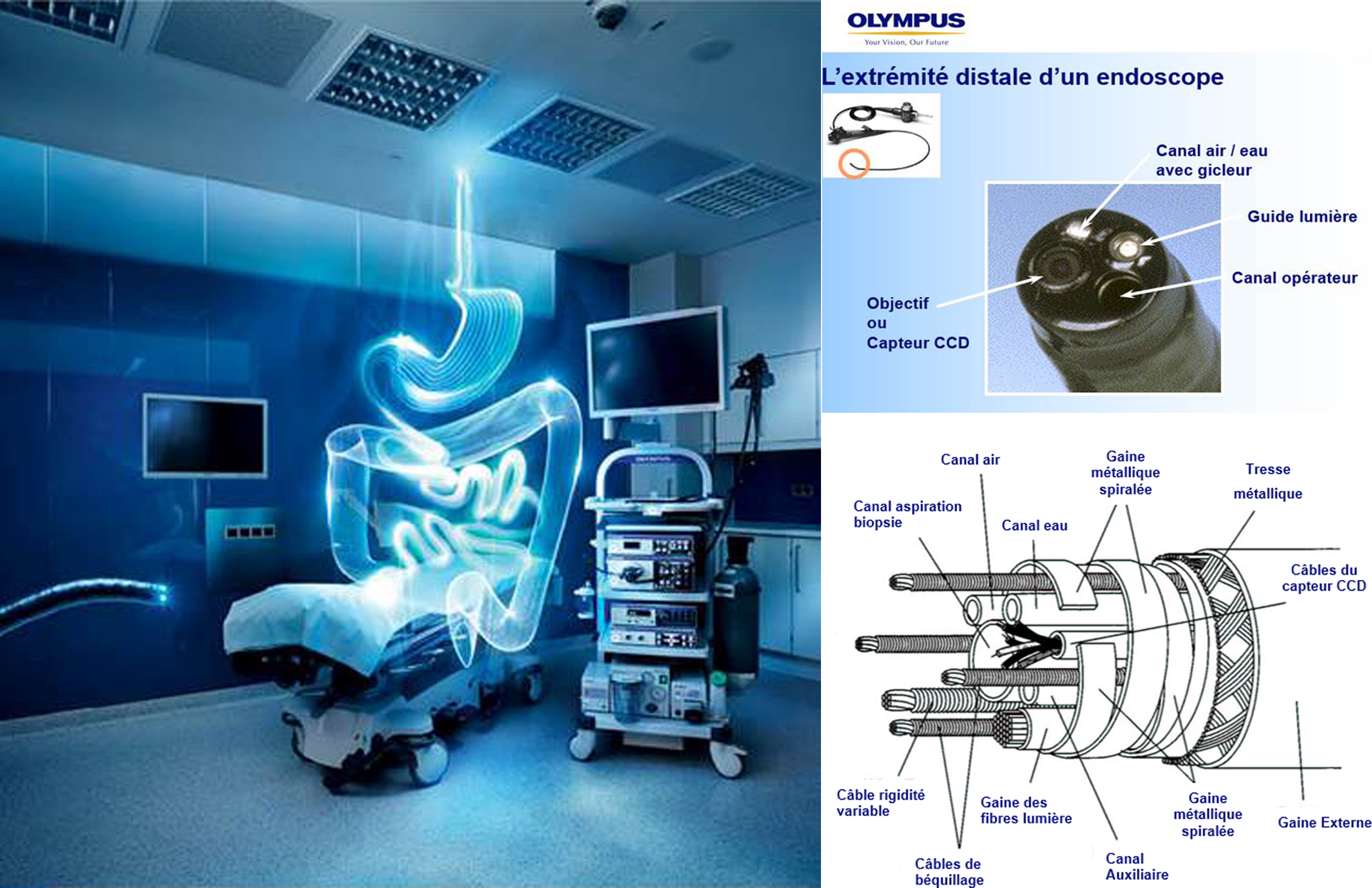 ATMOS Scope – Pour l'endoscopie ORL et le diagnostic de la déglutition